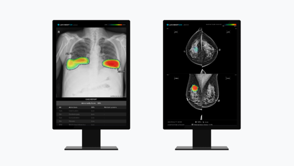 루닛의 흉부 엑스레이 AI 영상분석 설루션 '루닛 인사이트 CXR'(왼쪽)과  유방촬영술 AI 영상분석 설루션 '루닛 인사이트 MMG'. [사진 루닛]